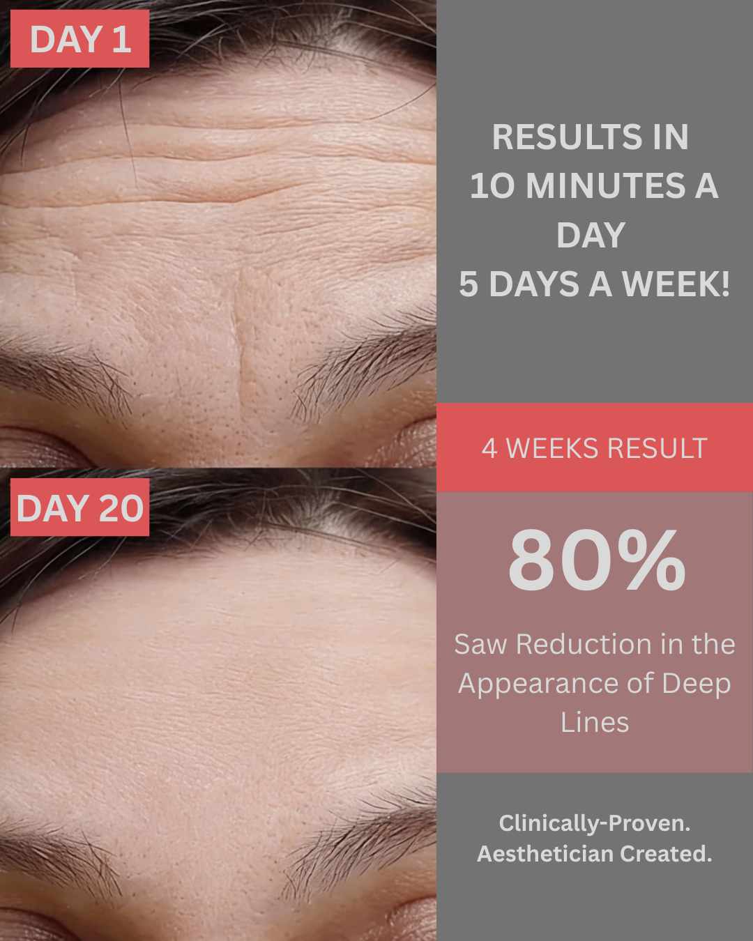 VellaGlow™ Photon Rejuvenation LED Face Mask